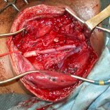 Angiologie en Vasculaire Chirurgie