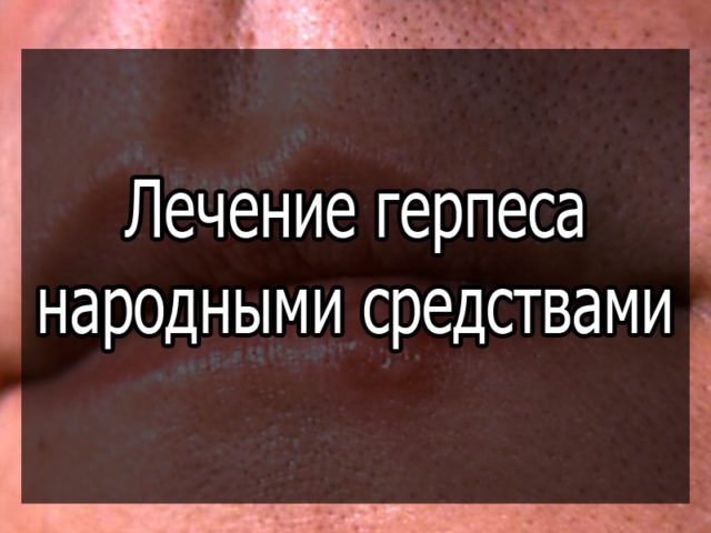 herpes treatment with folk remedies