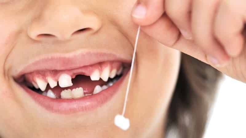 Czy zęby trzonowe zmienić kolejność erupcji u dzieci