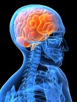 Ischémia mozgu