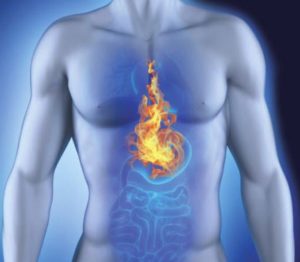Heartburn from water: why it occurs, what to do