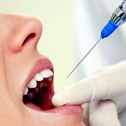 Anesthesia in dentistry