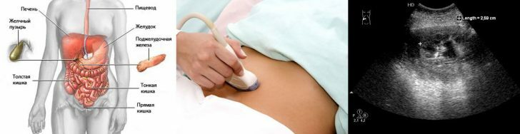 Ultralyd af maven: indikationer, forberedelse, fortolkning af resultater