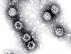 Tarminfluensa