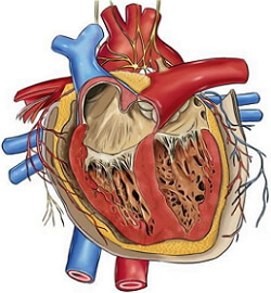 Cardiac tamponad