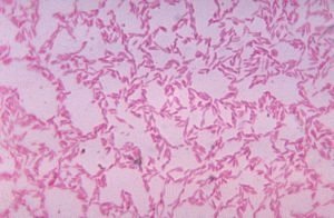 Disbacteriosis en bebés: síntomas, causas y tratamiento.