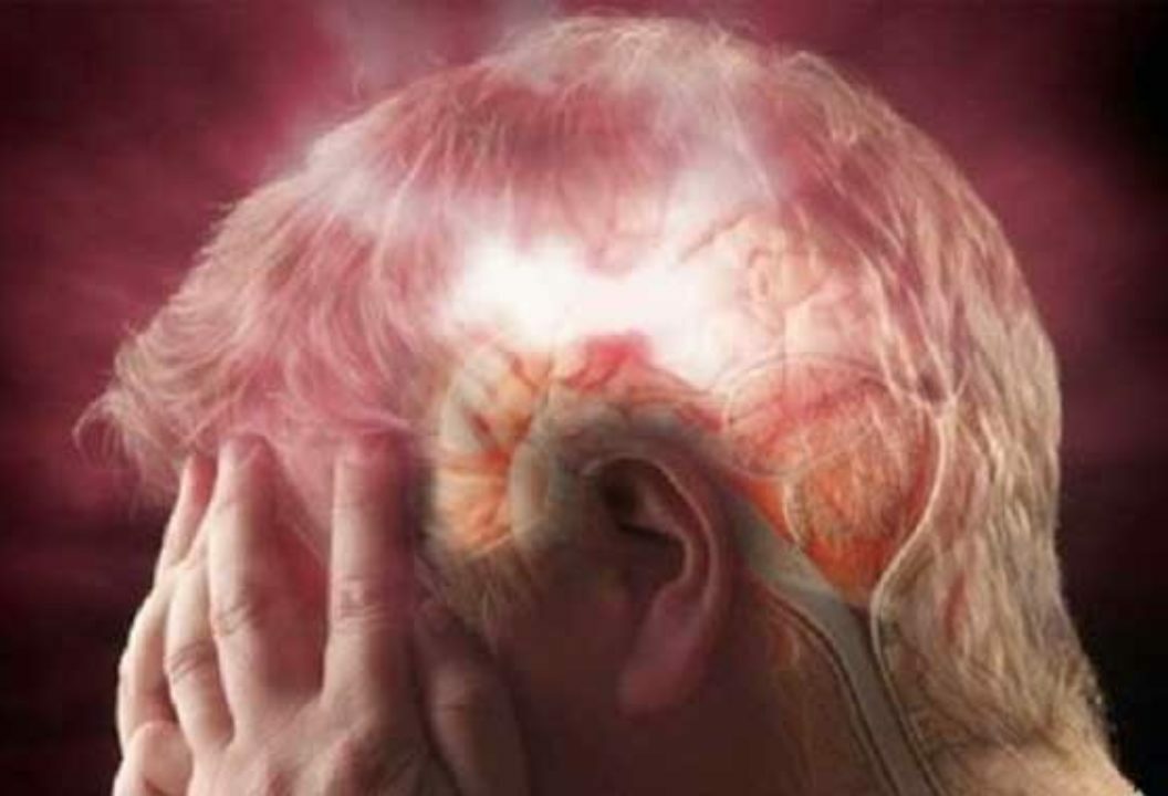 Hirnblutung: Anzeichen, Ursachen und Behandlung, Prognose