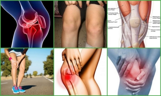 Meniskopatiya la rodilla: causas, síntomas, diagnóstico, tratamiento