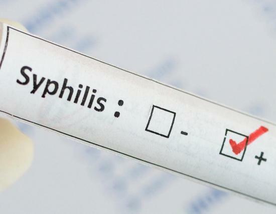 Après un certain temps la syphilis manifeste d'une personne infectée?