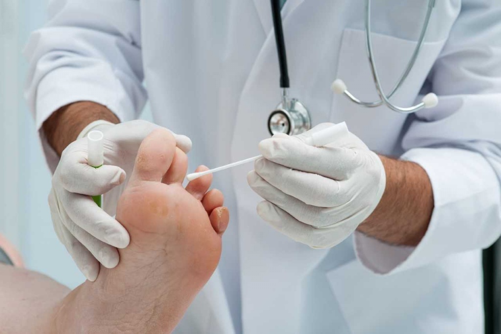 How to treat toenail fungus: remedies for treating fungus at home