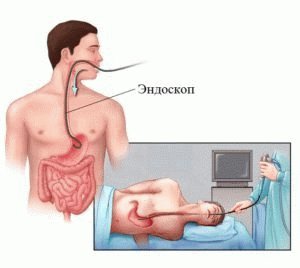 Gydytojas diagnozuoja pacientui opą