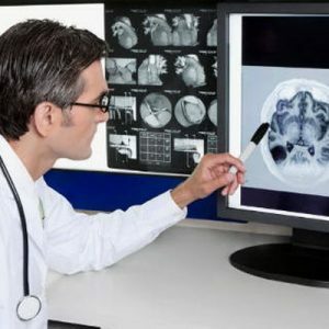 Computadorizada cerebral tomografia 3