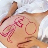 Presentación pélvica del feto y del cordón umbilical