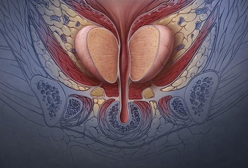 Prostata massasje med hemorroider: hva er begrensningene i å gjennomføre