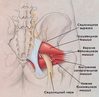 Neuralgia of the external cutaneous nerve of the thigh