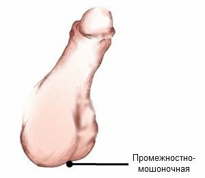 perineale-scrotum