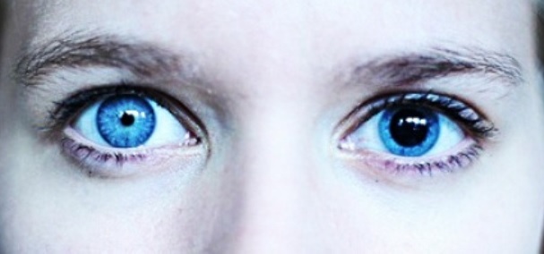 Anisocoria: Warum Pupillen unterschiedlicher Größe?