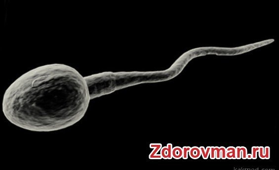 Spermie