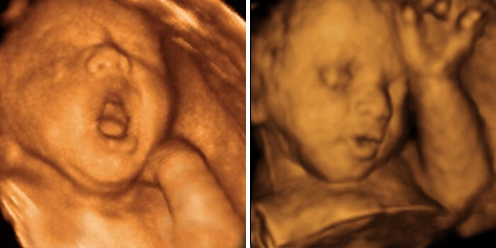26 tjedana trudna: Fetalni razvoj i osjećaj žene