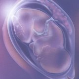 Gefrorene Schwangerschaft und Vakuum