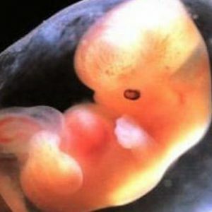 7-week-placenta