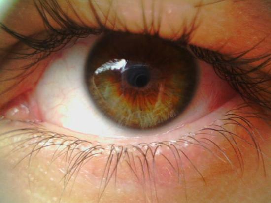 Rupture of the macula, symptoms, how it is diagnosed, principles of treatment