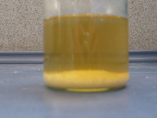 Bräunliches urin