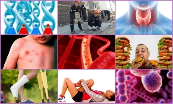 Субцхондрал остеосцлеросис: узроци, симптоми, лечење