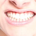 Zähne und Zahnfleischerkrankungen beim Menschen