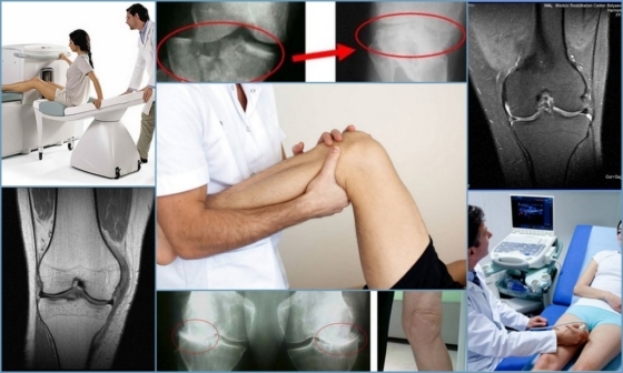 Das Knie Ligamentoz: was es ist, Ursachen, Symptome, Behandlung