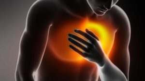 Heartburn from coffee