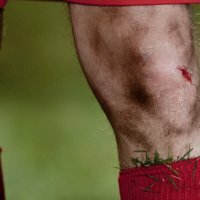 Vrste poškodb kolena