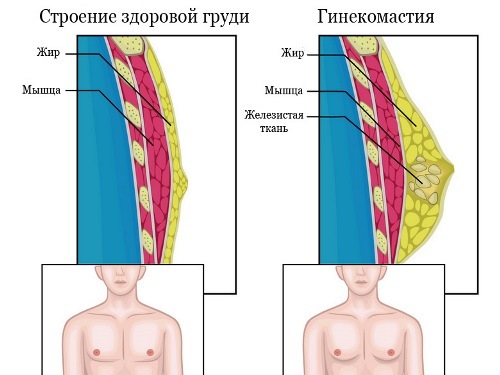 What shows the ultrasound of the mammary glands in men, the evidence for