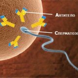 Antisperm-Antikörper im Blut