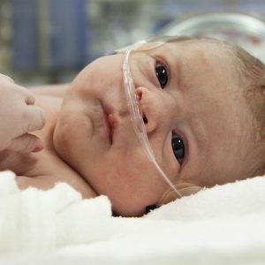 Asfiksija novorođenčeta: stupanj, efekti, prva pomoć kod gušenja