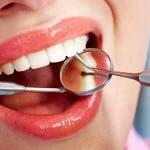 Do wisdom teeth treat?