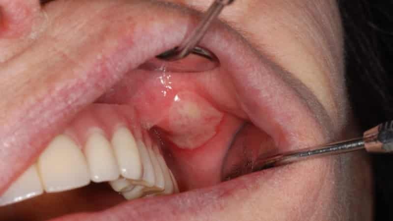 obraz zub boli ali ne boli