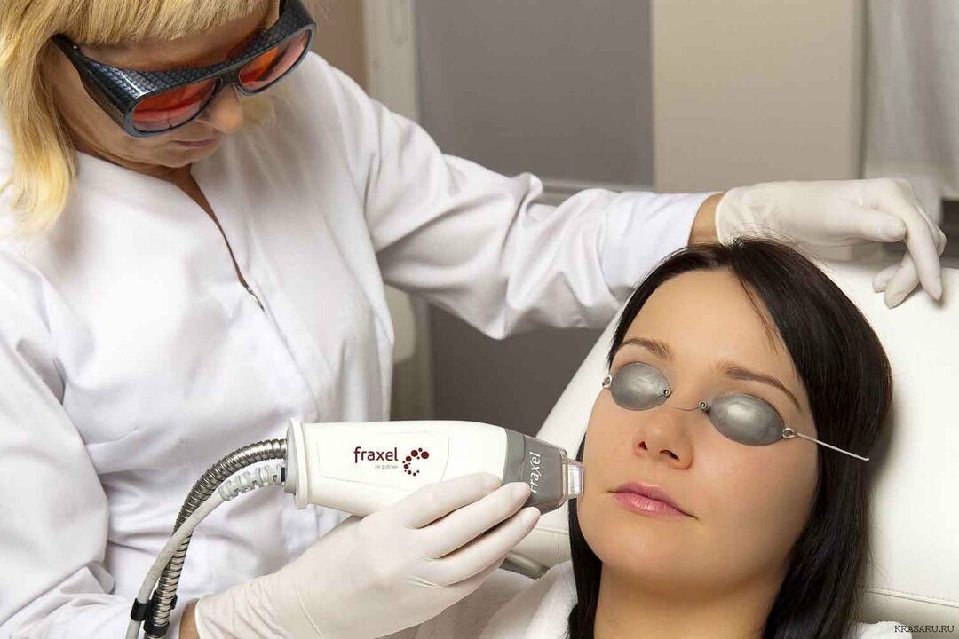 Laser-cosmetology-corrects-appearance