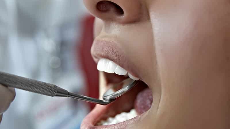 Geschwollenes Zahnfleisch, aber der Zahn nicht verletzt