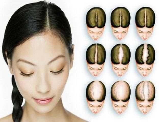 Mi okozza a hajhullást a fejen?