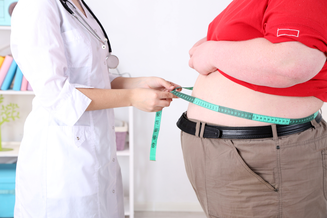 Surgical treatment of obesity