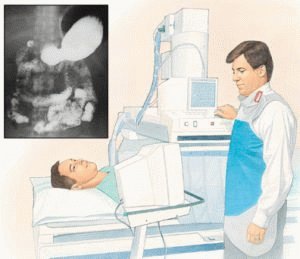 Hoeveel gastritis wordt behandeld: duur van het dieet en medicatie
