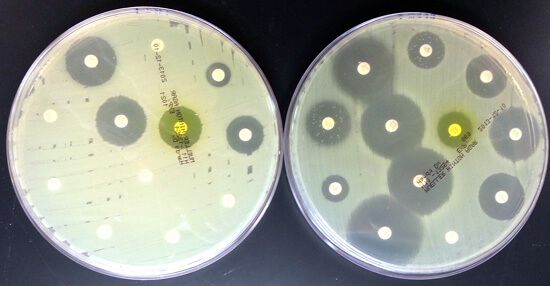 Kako liječiti Staphylococcus aureus