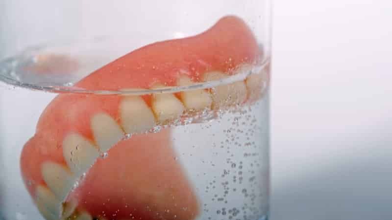 Mitä ovat hammasproteesit: tyypit, luokittelu ja valokuvia