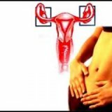 Pregnancy and inflammation of the ovaries
