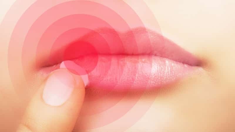 Herpes an der Lippe während der Schwangerschaft Behandlung