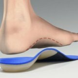 Flatfoot: a description of the disease
