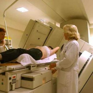 Irradiation-for-cancer1