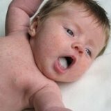 Revestimento branco na língua dos recém-nascidos