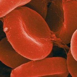 Causes et signes de la coagulation du sang, produits pour l'amincissement du sang